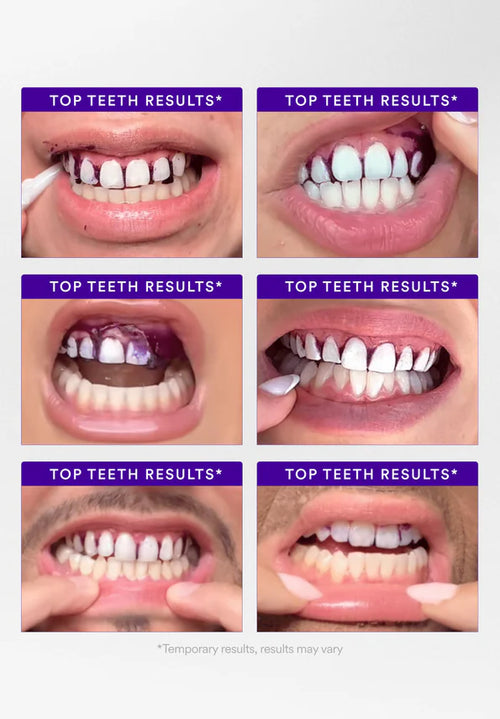 Collage of six images showing close-ups of teeth with 'Top Teeth Results' text above each.